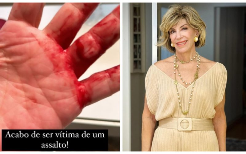 Ataque em Higienópolis: Vídeo Revela Momento em que Assaltante Agride Silvia Poppovic por Anel