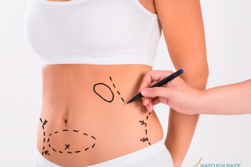 O Impacto da Cirurgia Plástica na Autoestima e no Bem-Estar Emocional