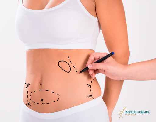 O Impacto da Cirurgia Plástica na Autoestima e no Bem-Estar Emocional